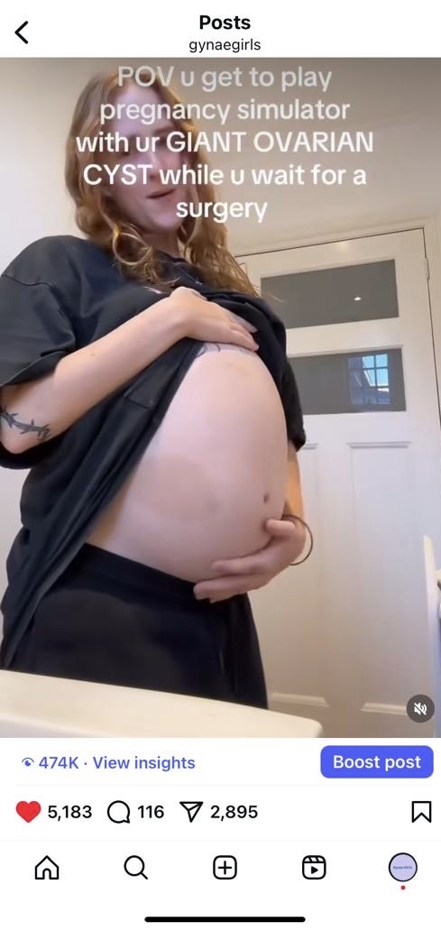Rust Gyn GynaeGirls